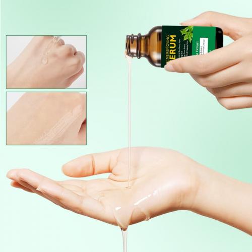 Сироватка для обличчя Tea Tree Acne Treatment